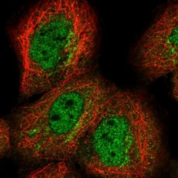 MED8 Antibody, Novus Biologicals 25 &mu;L; Unlabeled:Antibodies, Polyclonal
